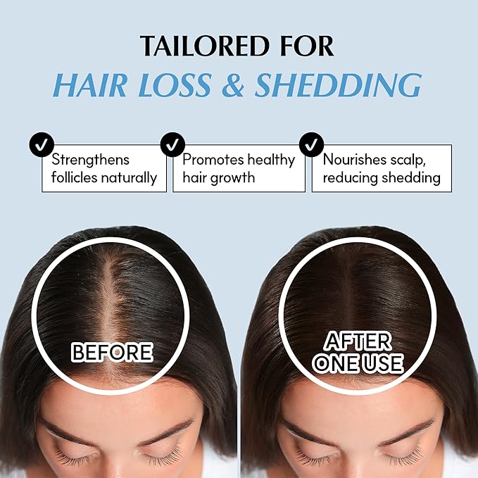 RATED GREEN REAL GROW Anti Hair Loss Treatment | Hair Strengthening Shampoo for Thinning Hair | Organic Rosemary Shampoo for Women 6.76 fl oz