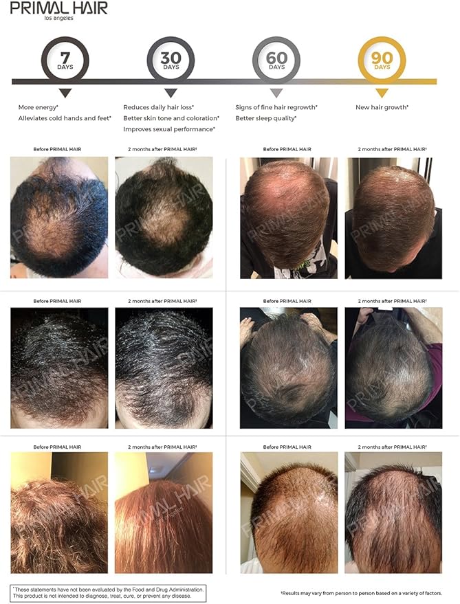 100% Natural Growth Treatment, Reduces Hair Loss, US Patented Formula Proven Effective for Men & Women, 100% Vegan Ingredients, Non-GMO, 30-Day Supply