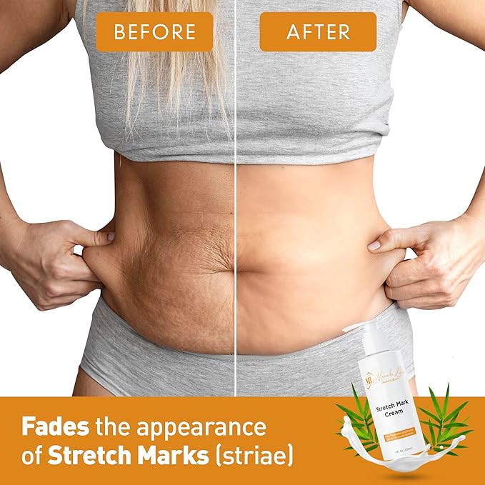 Stretch Mark Cream, Belly Butter & Scar Cream, Skin Care with Active Skin Repair, Stretch Mark Removal, For All Skin Types, 4 Oz - ML Delicate Beauty
