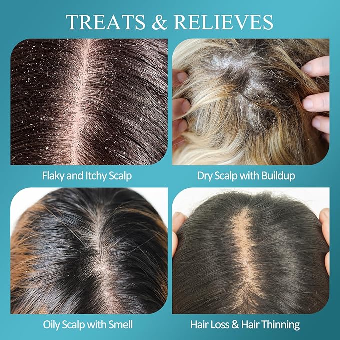 Scalp Scrub, Biotin 2-in-1 Scalp Exfoliator Scrub Clarifying Detox Shampoo with 3% Salicylic Acid & Tea Tree for Dandruff, Build Up, Itchy Scalp, Oily Hair & Dry Scalp Treatment with Scalp Massager