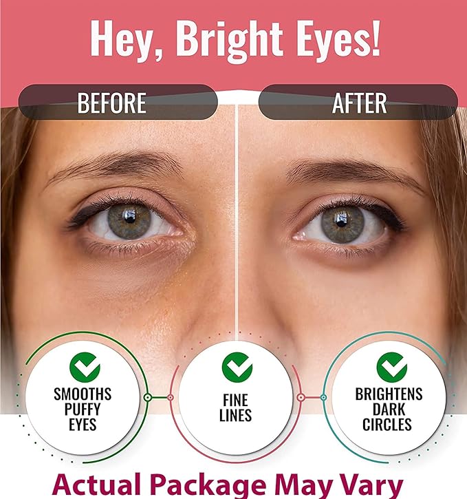 Eye Mask for Puffiness - Under Eye Patches for Dark Circles - Korean Under Eye Mask Patches for Puffy Eyes - Eye Gel Pads Depuffing Eye Brightener, Caffeine, Hydrogel & Collagen (20 Pairs)