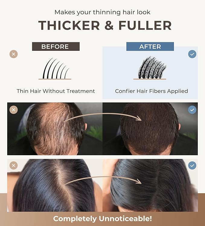 Keratin Hair Fibers for Men & Women - Fill In Fine or Thinning Hair, Instantly Thicker, Fuller Looking Hair (Light Blonde 30g)