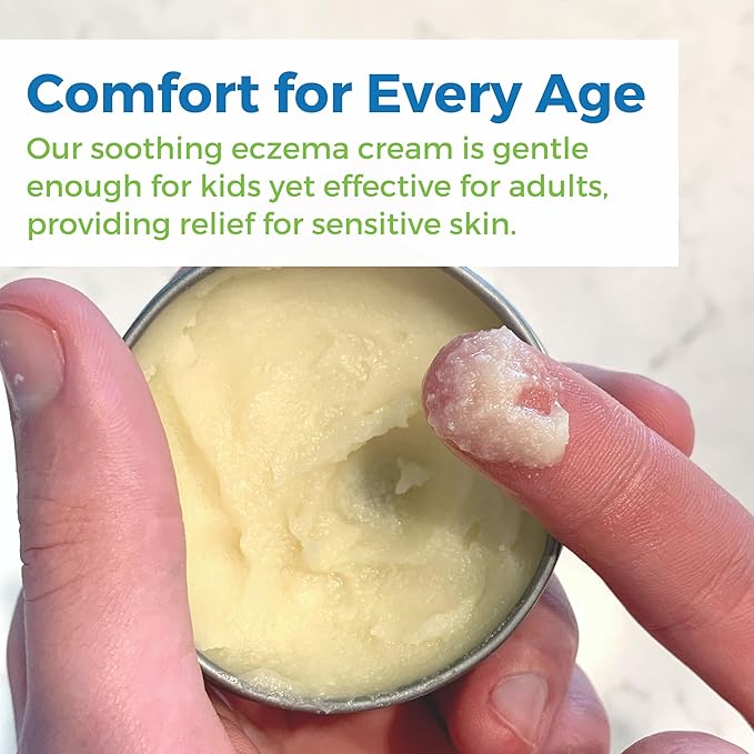 Waxhead Aftersun Body Butter for Sunburn Relief - Also great Tattoo Balm, Eczema Cream for Kids Adults, After Sun Lotion, Sunburn Treatment, Healing Salve
