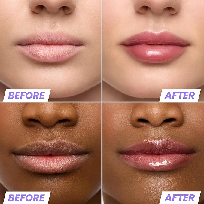 Wonderskin Lip Oil Rehab Serum - Tinted Lip Oil, Hydrating, Moisturizing, and Non-Sticky Deep Red Tint Serum for Dry Lips (Honey)