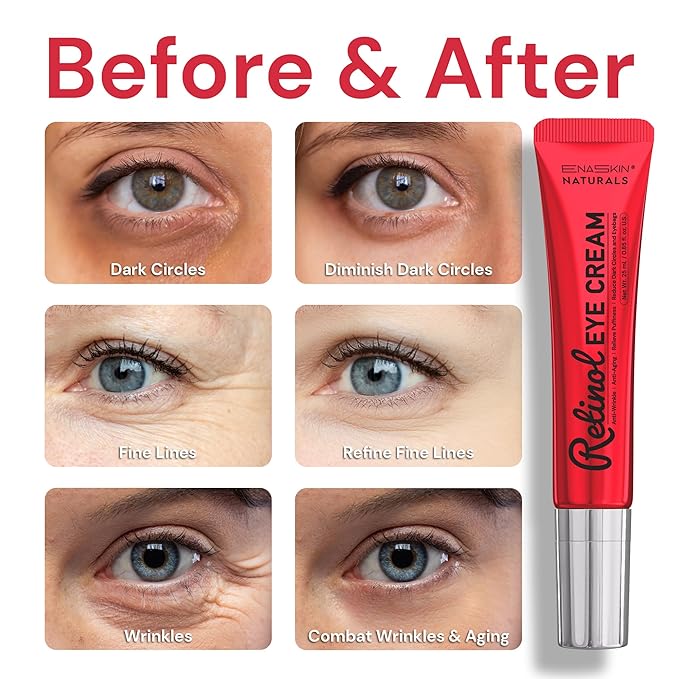 Anti-Aging Eye Cream for Wrinkles: Lifting and Tightening Under Eye Cream with Retinol & Collagen - Fine Lines Smoothing Treatment, Reduces Dark Circles, Eye Bags & Puffiness In 2 Weeks | 1.53 fl. oz