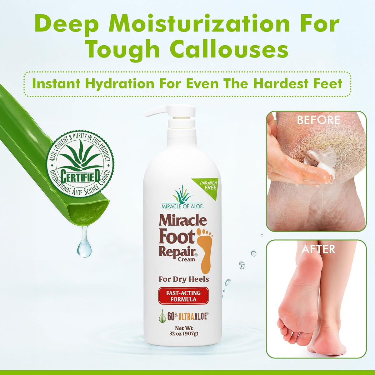 Miracle Foot Repair Cream (32 oz) Repairs Dry Cracked Heels and Feet, 60% Pure UltraAloe Moisturizes, Softens, and Repairs