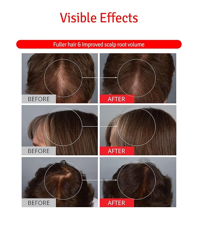 Scalp+ Shampoo for DHT Blocker, Hair Loss Relief - Moisture Anti-Aging Thickening Volumizing Fortifying & Repairing Hair Strength Fuller Hair with Vitamin C, Peptides, Biotin, 10.14 fl.oz.