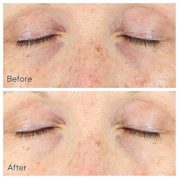 Murad Vita-C Eyes Dark Circle Corrector – Environmental Shield Vitamin C Brightening Serum – Anti-Aging Treatment for Puffiness and Wrinkles, 0.5 Fl Oz