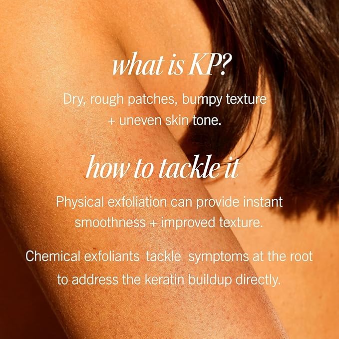 First Aid Beauty - KP Bump Eraser Body Scrub with 10% AHA, Keratosis Pilaris Skin Exfoliator with Glycolic and Lactic acids, Helps Reduce Chicken Skin Bumps, Safe for Sensitive Skin, 2 oz