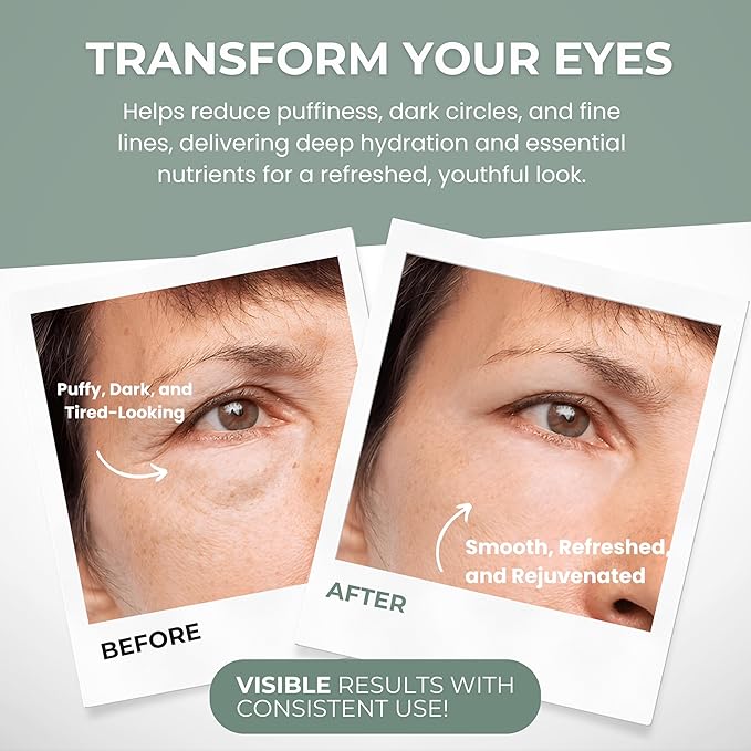 Under Eye Gel - Premium Anti Aging Eye Cream for Dark Circles & Puffiness, Treatment On, Eye Bags Gone, Brightness Glows, 1.7 oz.