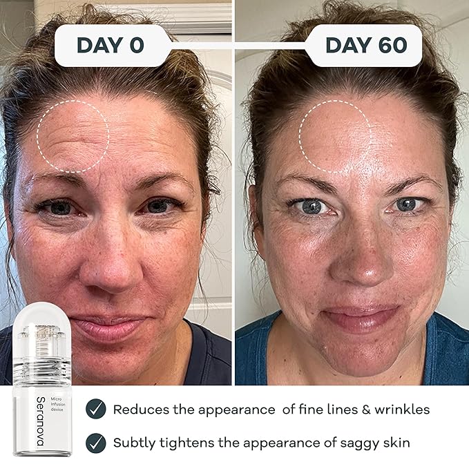 Seranova - Micro Infusion for Skin Care (2-Month Supply)