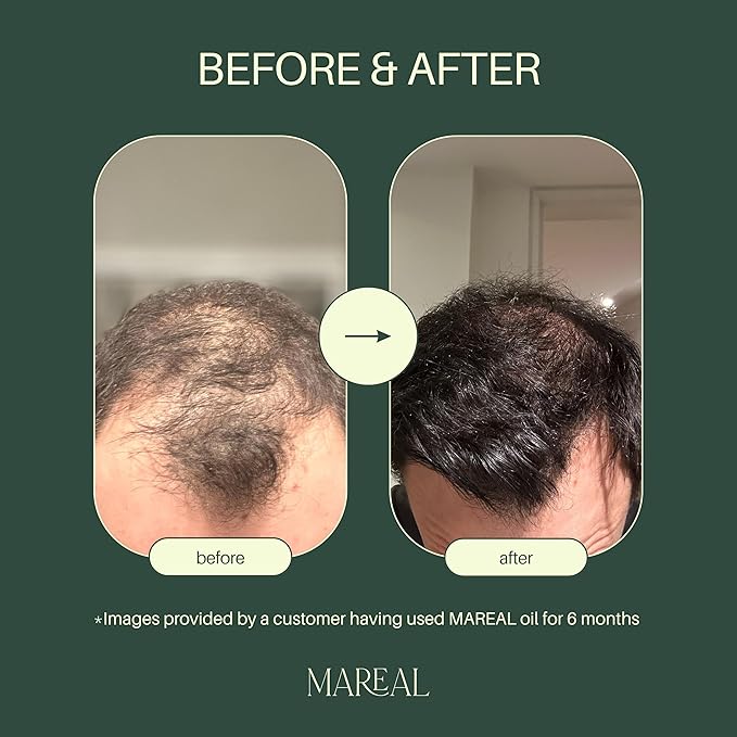 Pure Rosemary Oil for Hair Growth & Scalp Health | Infused with Castor & Coconut Oil | Hair Thickening & Regrowth Treatment for Women & Men | 100% Natural | Up to 2-Month Supply | 1.7 fl oz | MAREAL
