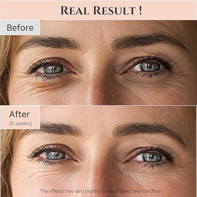 Beauty of Joseon Revive Eye Serum with Retinal Niacinamide Correction for Puffy Eye Bags Fine Lines Dark Circles Wrinkles, Korean Skin Care 30ml, 1 fl.oz