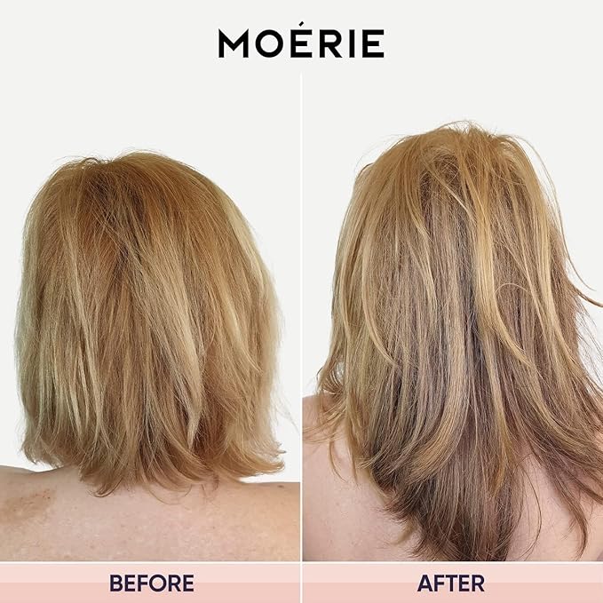 Moerie Hair Growth & Repair Mask - Restorative, Vegan-Friendly Treatment for Longer, Thicker, Fuller Hair - 100ml, 2 pack