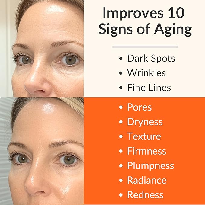 LeVaye Vitamin C Serum, Anti-Aging Face Serum – 15% Vitamin C, Ferulic Acid, Niacinamide, Hyaluronic Acid, Peptides, Ceramides – Targets Wrinkles, Fine Lines, Dark Spots, Enlarged Pores, Dry Skin