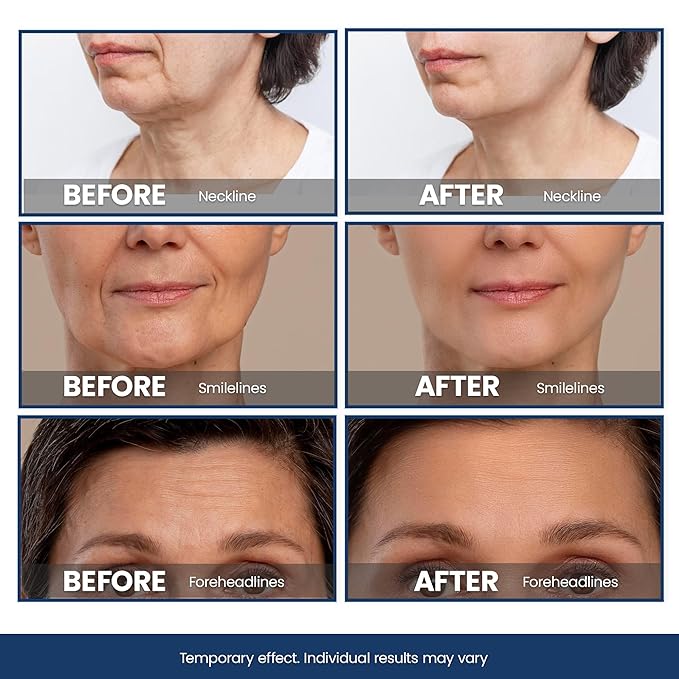 Bag Buster Eye Cream | Instant Reduction | Rapid Eye and Face Lift | Anti-Aging | instantly Reduces, Wrinkles, Dark Circles, Fine Lines, Under Eye Bags | Powdery Residue Or Flakes Free Formula | 10ml