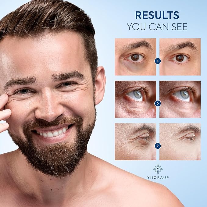 Eye Roller for Bags for Men: Men’s Caffeine Under Eye Cream for Puffy Eyes and Dark Circles Treatment – Cooling Stick Depuffer for Puffiness Reducer 0.45 fl. Oz.
