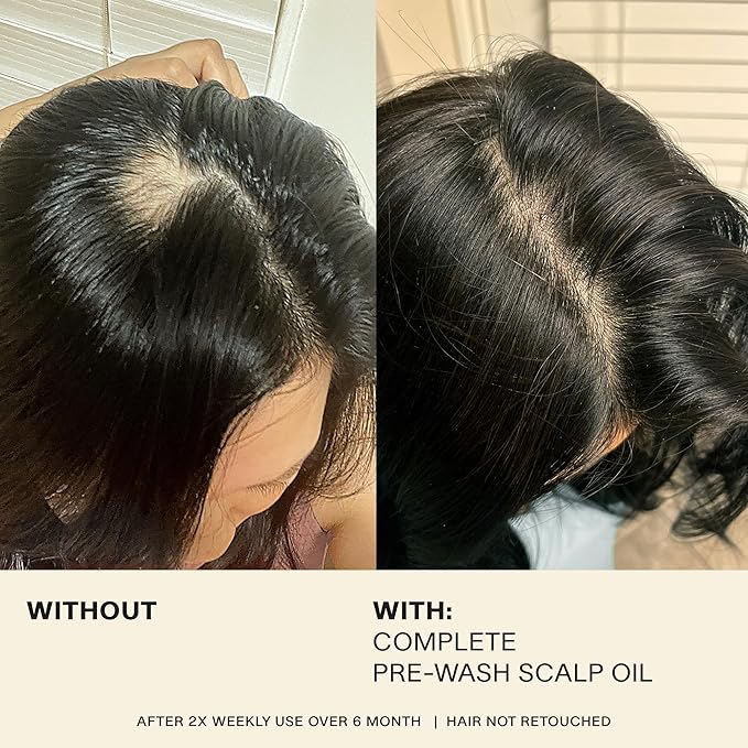 JVN Pre-Wash Scalp Oil & Hair Treatment Oil, Pre Shampoo Dry Scalp Treatment, Scalp Cleansing Oil for All Hair Types, Sulfate Free (1.7 Fl Oz)